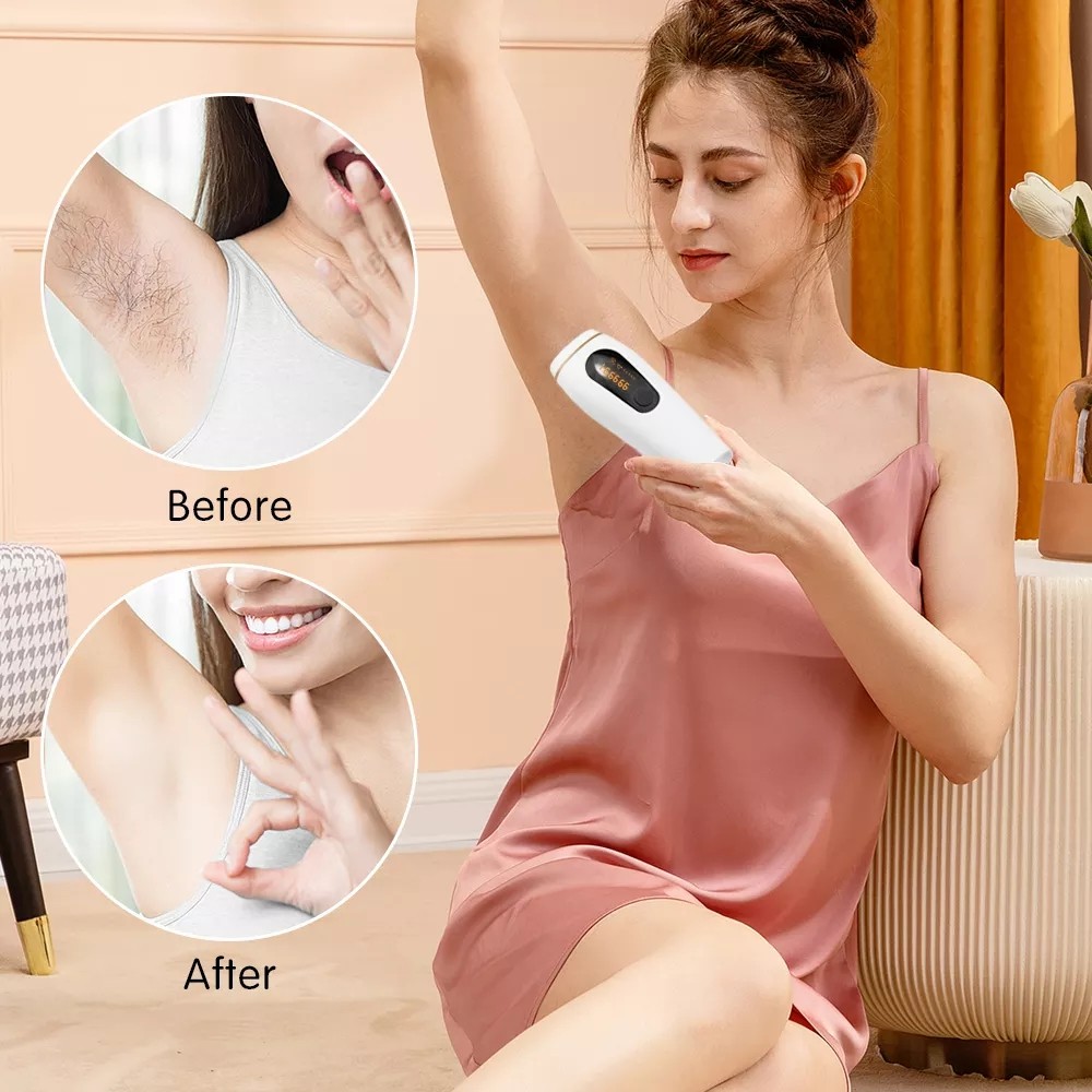 Multifunction Lady  Electric Hair Hair Face Remover Machine